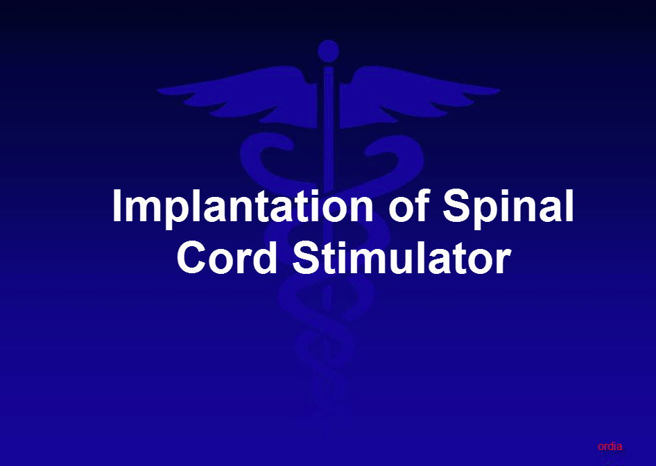 Implantation of Spinal Cord Stimulator